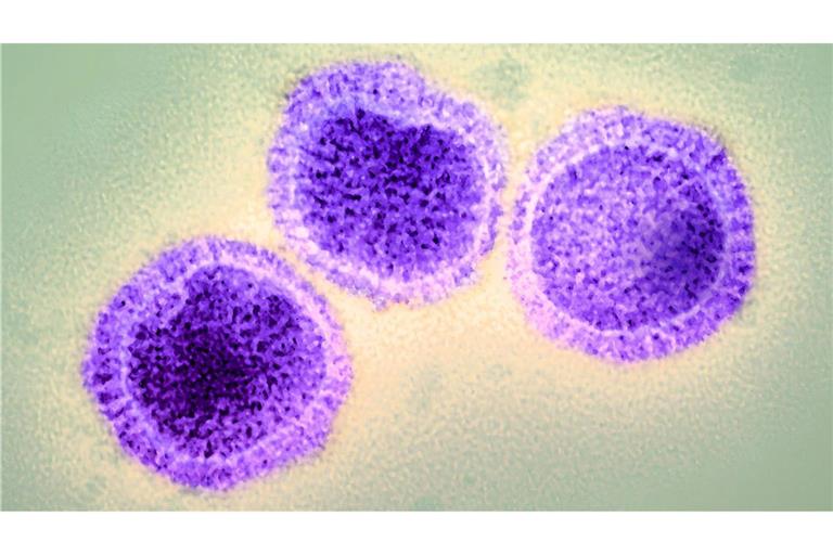 Aufnahme von Influenza-Viren mit dem Elektronenmikroskop.