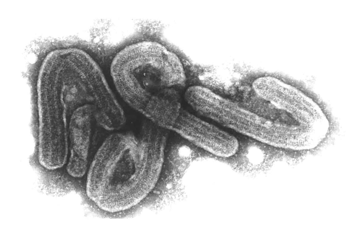 Das Marburg-Virus gehört zu den gefährlichsten bekannten Krankheitserregern.