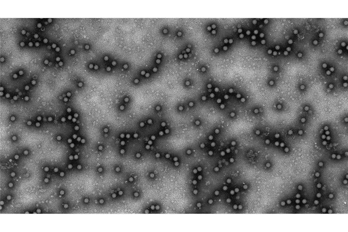 Der erstmalige Ausbruch des Virus in Deutschland seit rund 35 Jahren hat viele überrascht. (Archvibild)