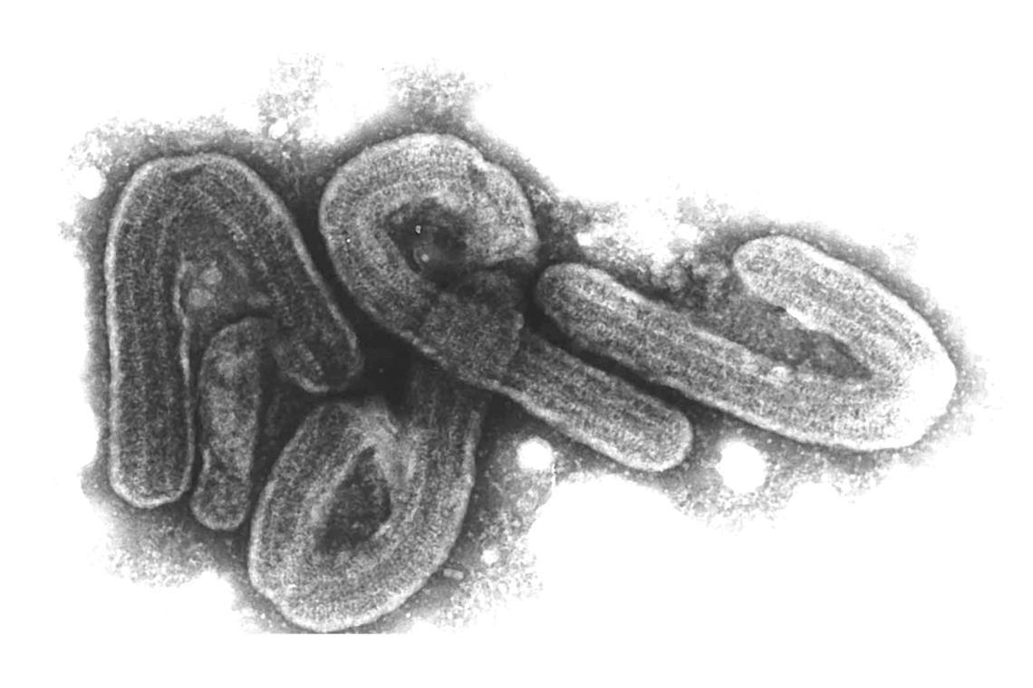 Eine elektronenmikroskopische Aufnahme des Marburg-Virus.